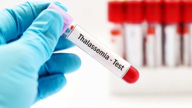 Is Thalassemia Hereditary?