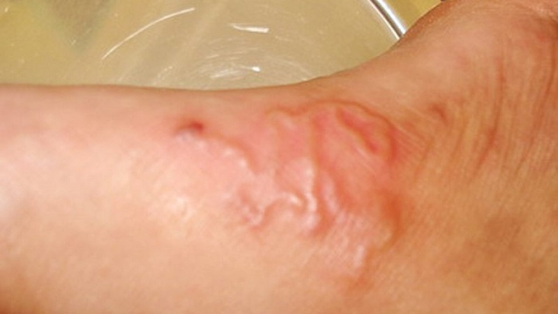 Why Do People Get Dog Tapeworm? Causes, Symptoms, and Prevention